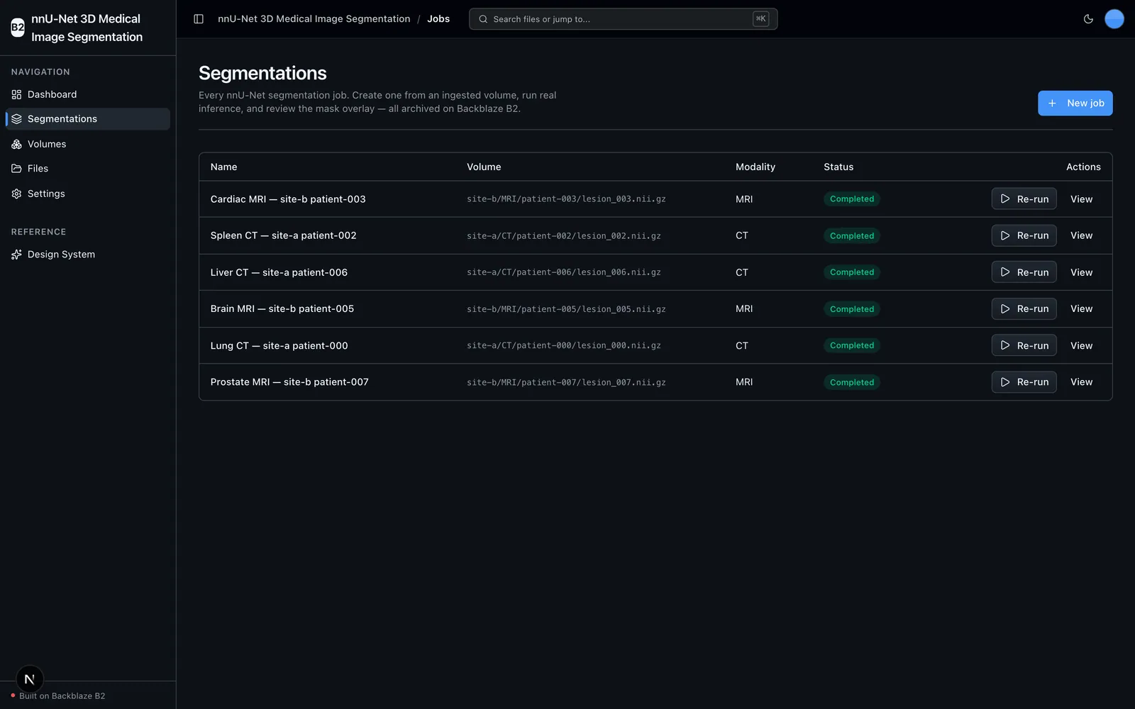 Segmentations list of CT and MRI jobs with status and re-run actions